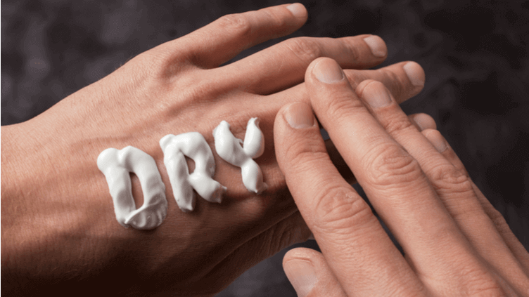 Dry skin during winter