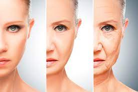 What accelerates skin aging