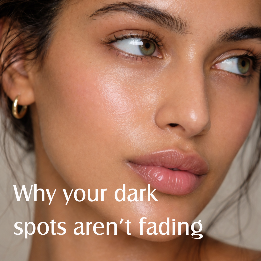 Why your dark spots aren’t fading