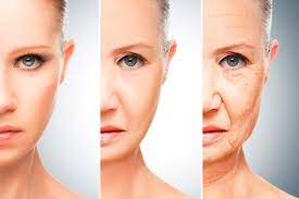 What accelerates skin aging