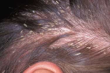 Scalp treatment is the new skincare
