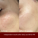 Before-and-after skin comparison showing the cheek area of a person's face, with red dotted circles highlighting skin texture and tone changes after 3 weeks of daily use. Text at the bottom reads 'before', 'after 3 weeks', and 'independent results after daily use AM & PM'.