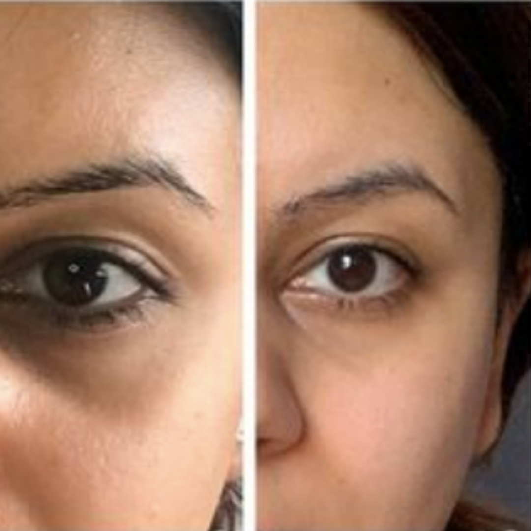 Customer photograph before use