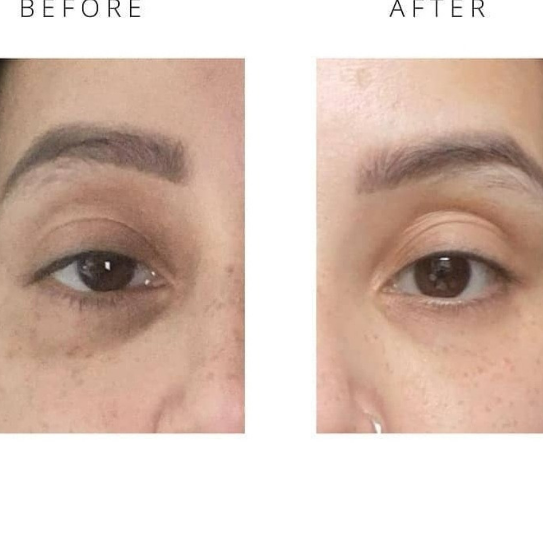 Customer photograph before use